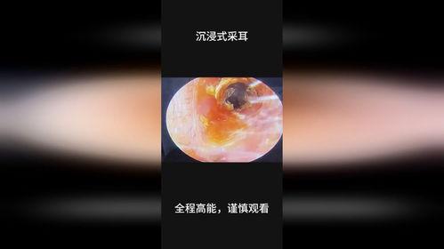 成人耳屎解压视频下载,揭秘成人心理释放新方式